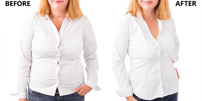 before and after weight loss program in Roseville